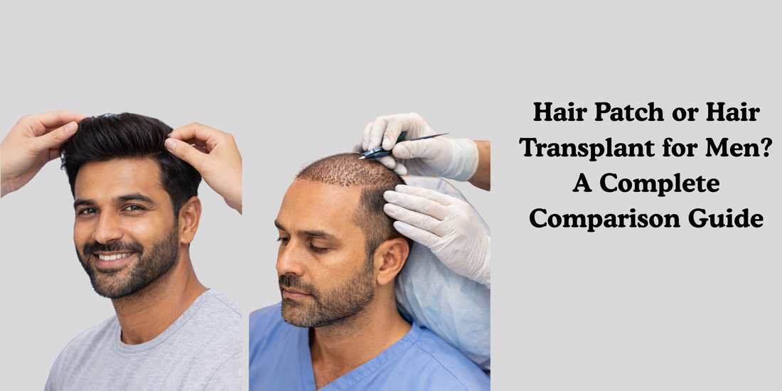 Hair Patch or Hair Transplant for Men? A Complete Comparison Guide