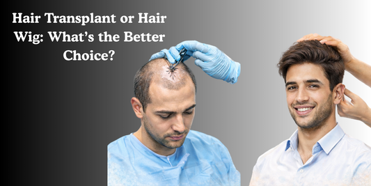 Hair Transplant or Hair Wig: What’s the Better Choice?