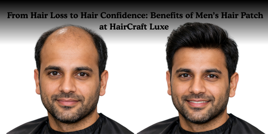 From Hair Loss to Hair Confidence: Benefits of Men’s Hair Patch at HairCraft Luxe