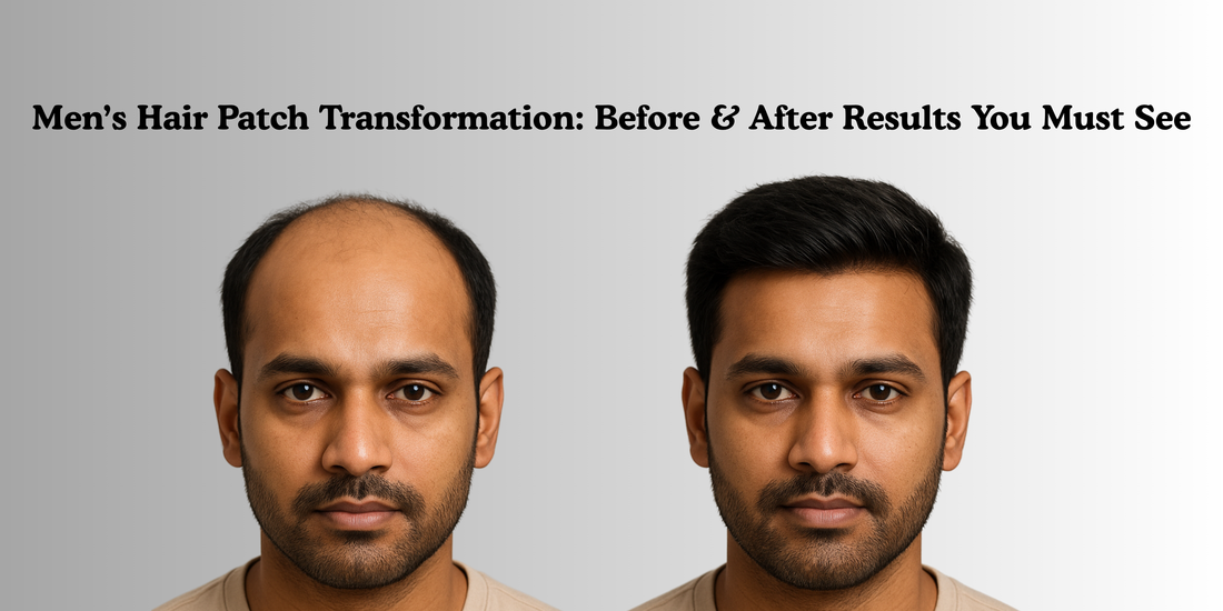Men’s Hair Patch Transformation: Before & After Results You Must See