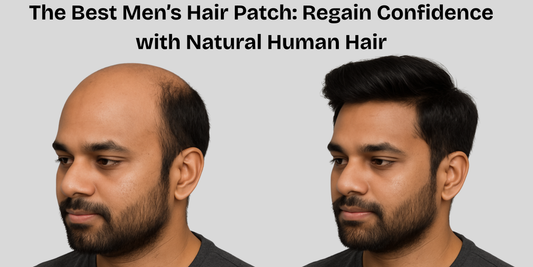 The Best Men’s Hair Patch: Regain Confidence with Natural Human Hair