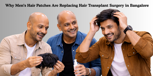 Why Men’s Hair Patches Are Replacing Hair Transplant Surgery in Bangalore