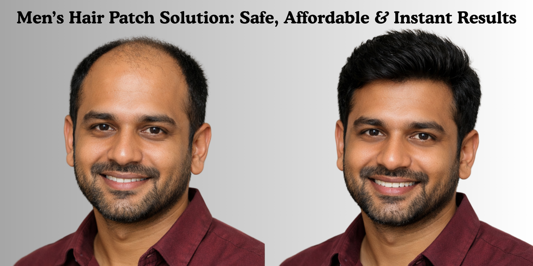 Men’s Hair Patch Solution: Safe, Affordable & Instant Results